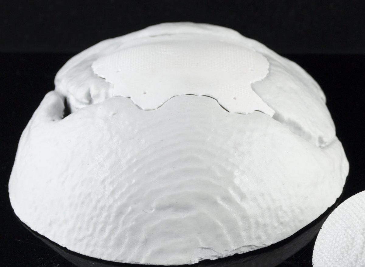 Placca cranica in ceramica tecnica realizzata su misura